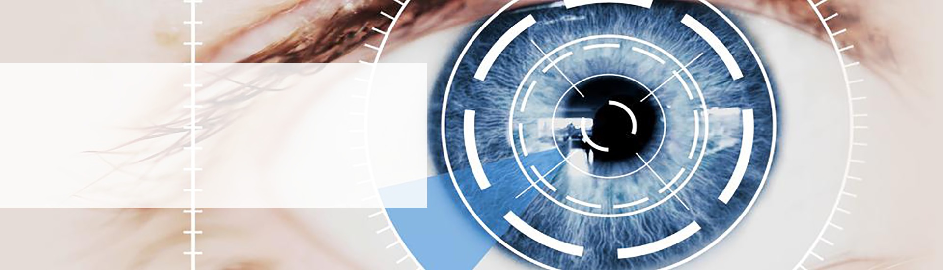 Servicio de cirugia laser para ojos
